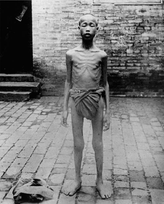 Photographie d'une victime de la famine chinoise de 1906-1907, la deuxième plus meurtrière d'Asie avec plus de 22,5 millions de victimes